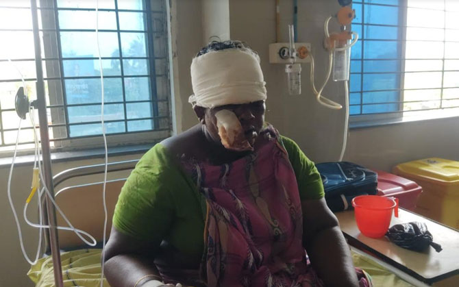 মেলেনি আবাস যোজনার ঘর, ছাদের চ্যাঙড় ভেঙে গুরুতর জখম বৃদ্ধা ও তার নাতনি
